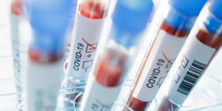 В Алматы выявлен новый пациент с COVID-19