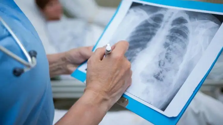 В Казахстане 52 человека заболели пневмонией с признаками коронавируса