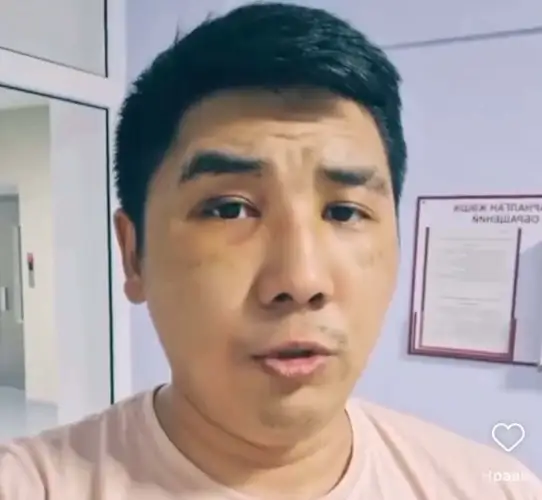 Водитель "скорой помощи" из Караганды простил избившего его хулигана